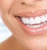 Diş Estetiği Uygulamaları